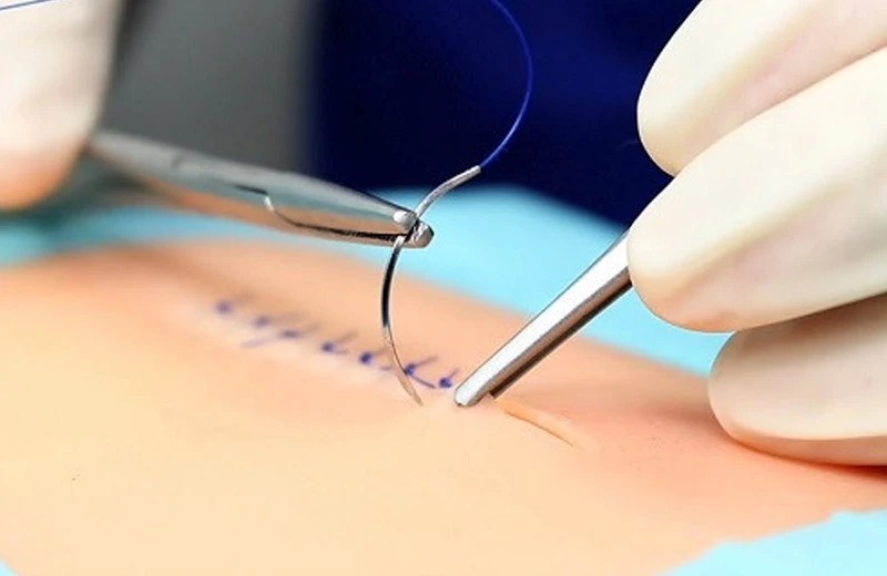 Ankara Evde Dikiş Alma Ankara Evde Dikiş Alma