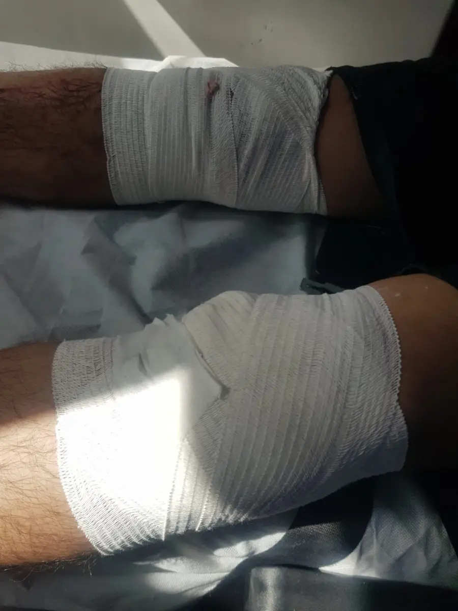 Ankara Evde Pansuman Hizmetleri Etimesgut Eryaman ve Çevresi