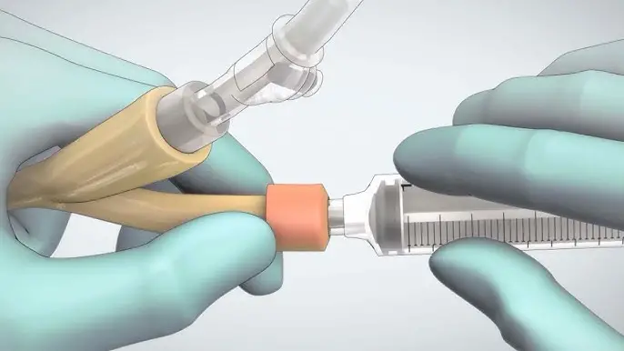 Ankara Evde İdrar sondası Takma Ankara Evde İdrar sondası Takma